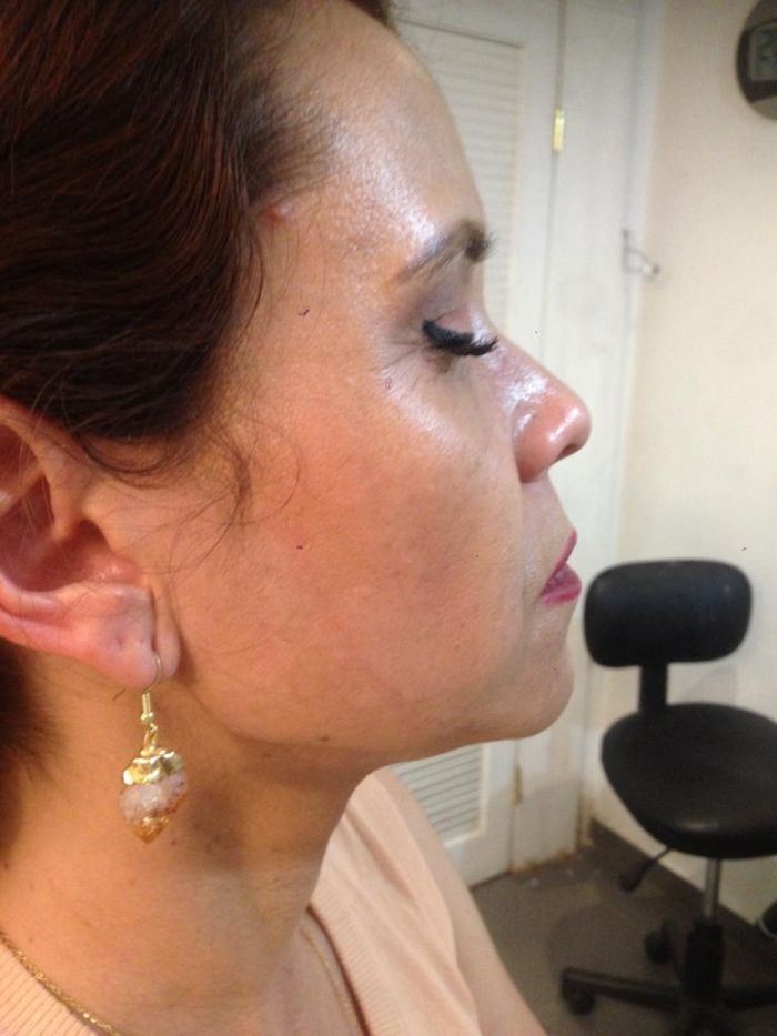 Clínica de las Américas, otorrinolaringólogo y cirugía facial
