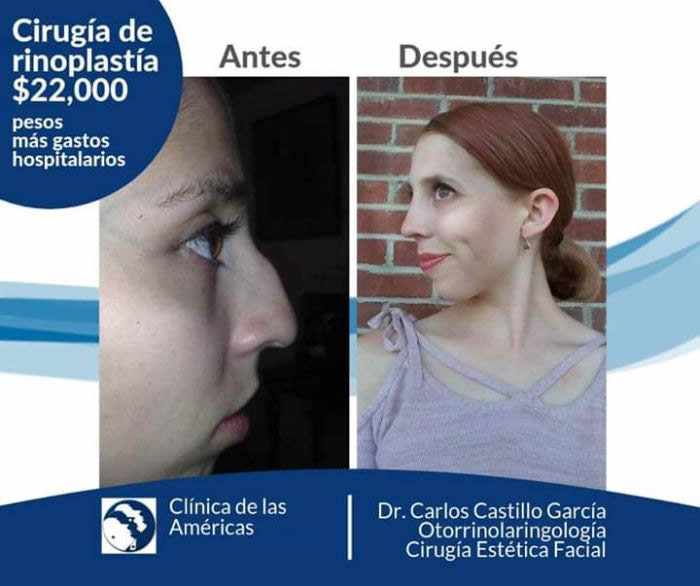 Clínica de las Américas, otorrinolaringólogo y cirugía facial